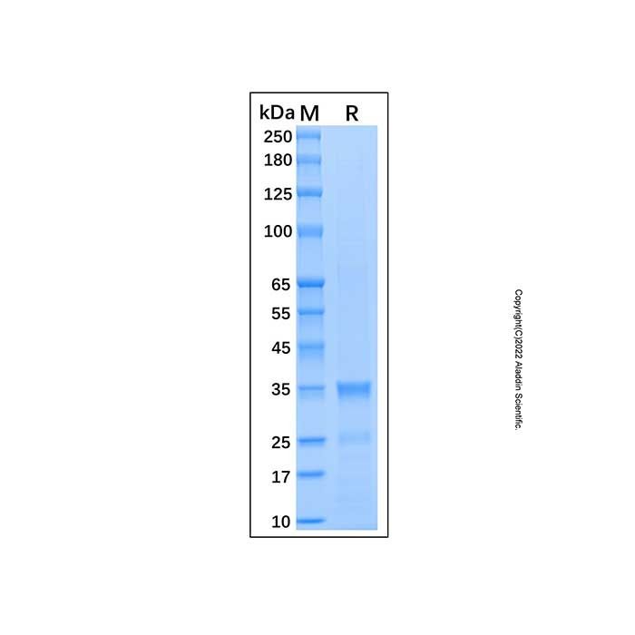 Recombinant Human Caspase-8 Protein -    by Aladdin Scientific