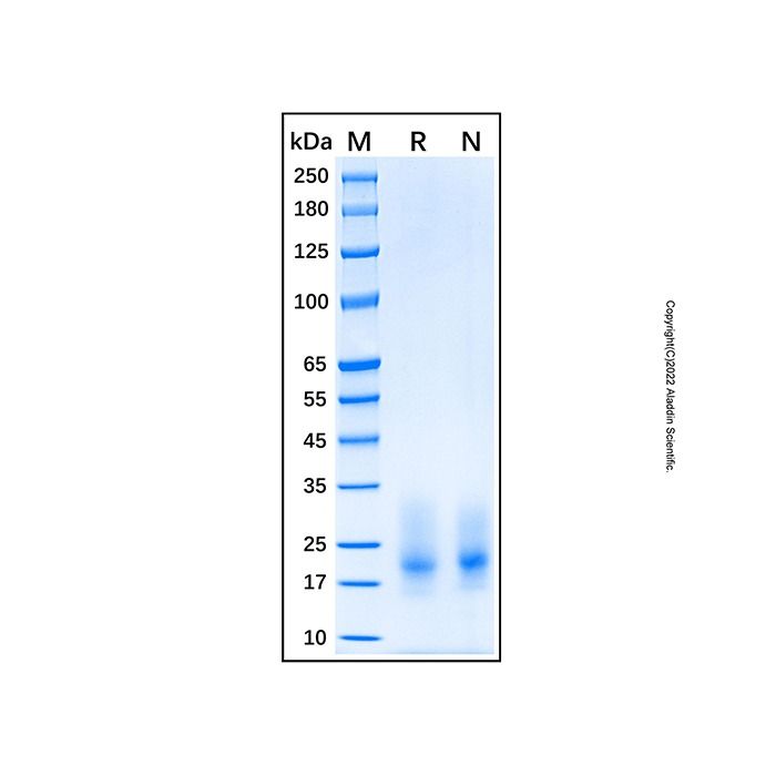 Recombinant Human CD63 Protein -    by Aladdin Scientific