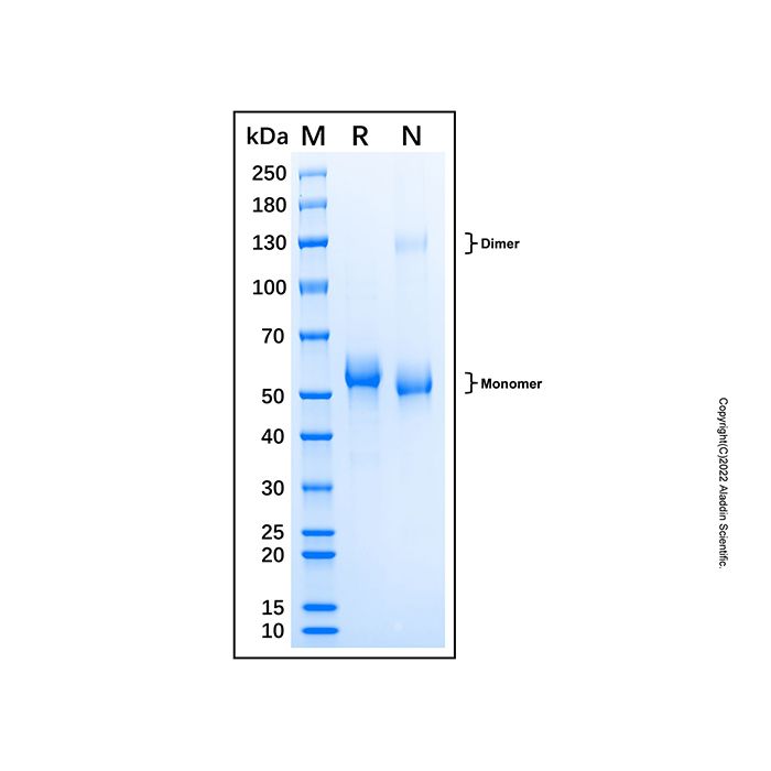 Recombinant Human Cathepsin C/DPPI Protein -    by Aladdin Scientific