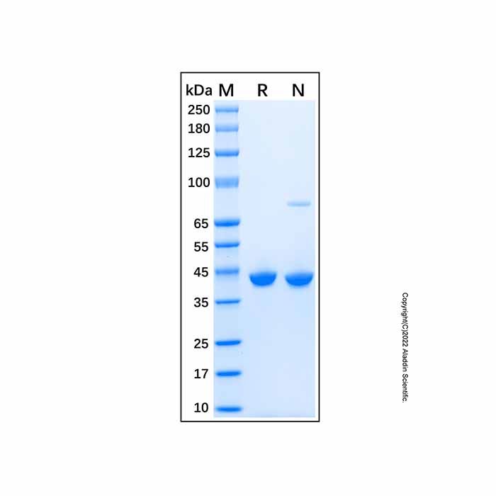 Recombinant Human YKL-40/CHI3L1 Protein -    by Aladdin Scientific