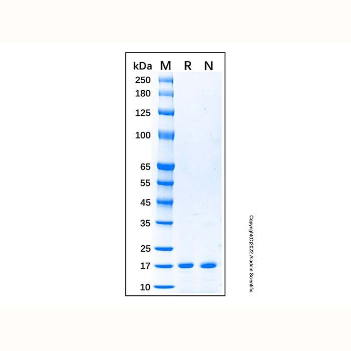 Recombinant Human Cystatin C Protein -    by Aladdin Scientific