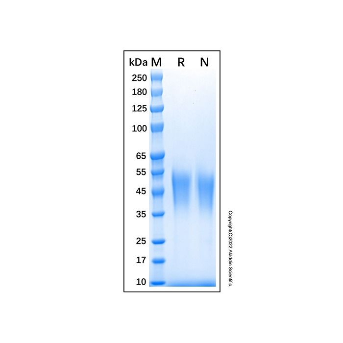 Recombinant Human Fc gamma RIIIA/CD16a Protein -    by Aladdin Scientific
