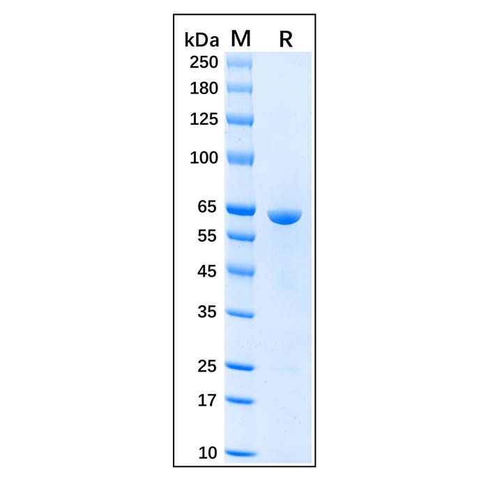 Recombinant Human Hsp60 Protein -    by Aladdin Scientific