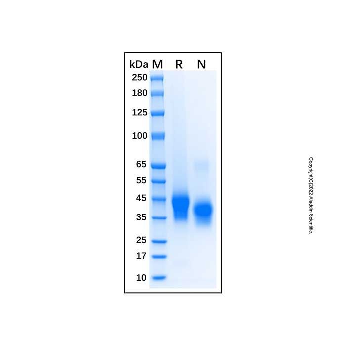 Recombinant Human CD25/IL-2R alpha Protein -    by Aladdin Scientific