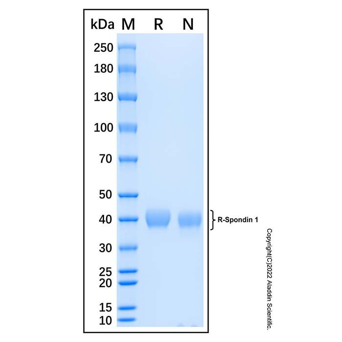 Recombinant Human R-Spondin 1 Protein -    by Aladdin Scientific