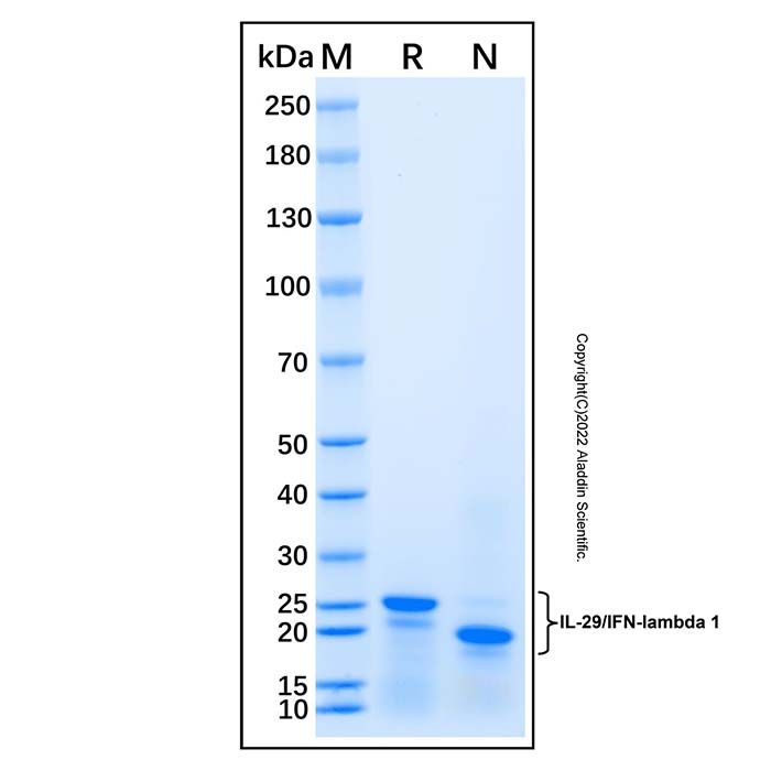 Recombinant Human IL-29/IFN-lambda 1 Protein -    rp169632 by Aladdin Scientific