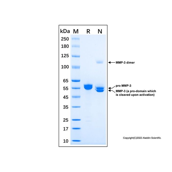 Recombinant Human MMP-3 Protein -    by Aladdin Scientific