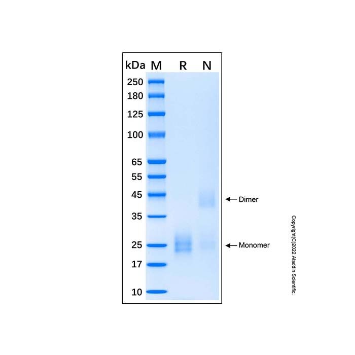 Recombinant Human IL-17E Protein -    by Aladdin Scientific