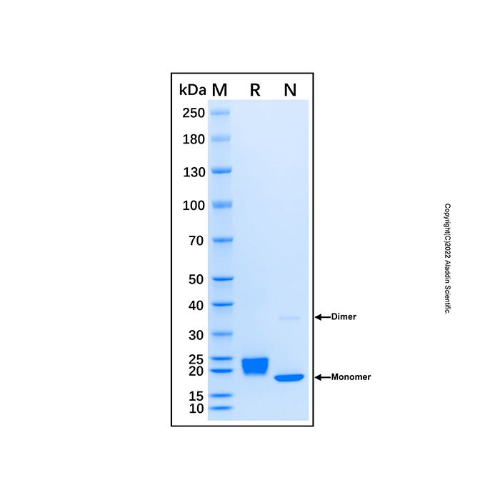 Recombinant Human IL-17C Protein -    by Aladdin Scientific