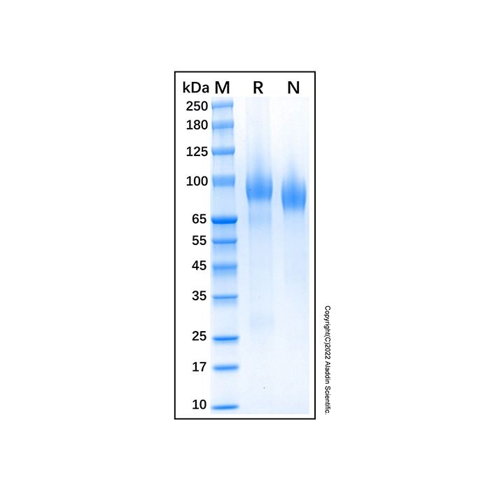 Recombinant Human ErbB3/HER3 Protein -    by Aladdin Scientific