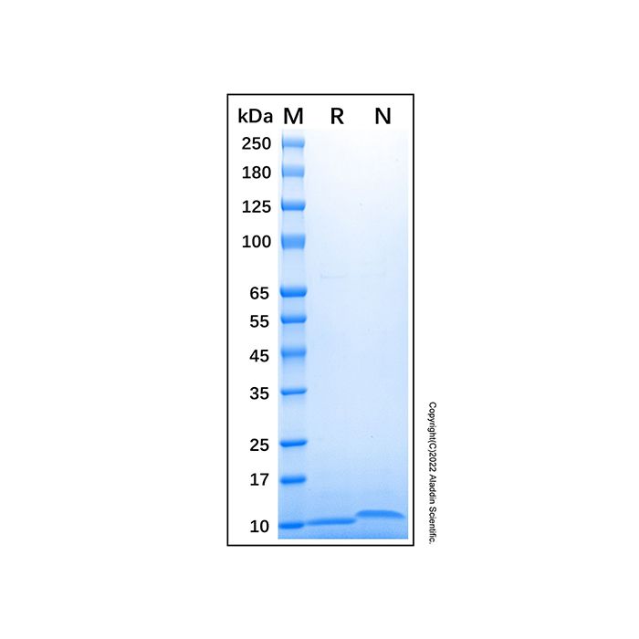 Recombinant Human CCL17/TARC Protein -    by Aladdin Scientific