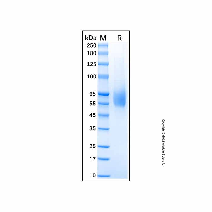 Recombinant Human EGFR Isoform vIII Protein -    by Aladdin Scientific