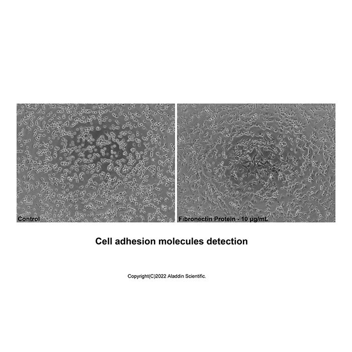 Recombinant Human Fibronectin Protein -    by Aladdin Scientific