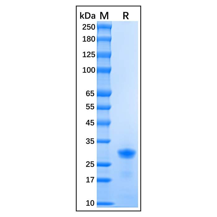 Recombinant Human p27 KIP 1 Protein -    by Aladdin Scientific