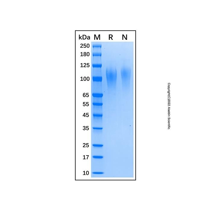 Recombinant Human TIM-1/KIM-1/HAVCR Protein -    by Aladdin Scientific