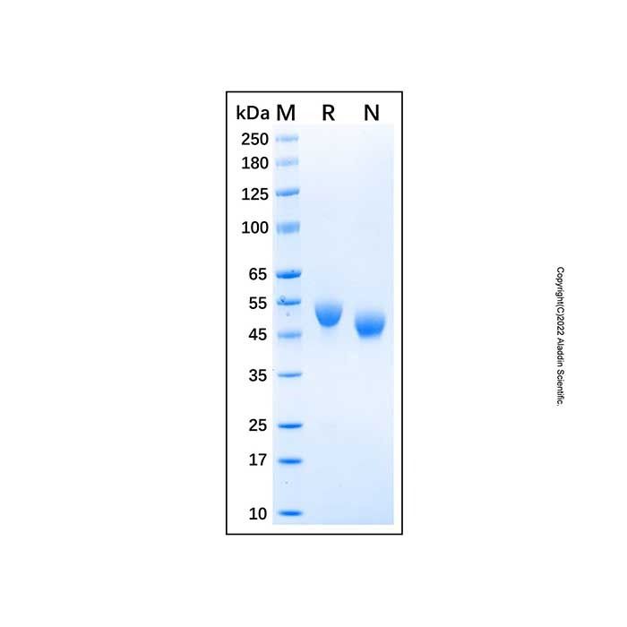 Recombinant Human CD5 Protein -    by Aladdin Scientific