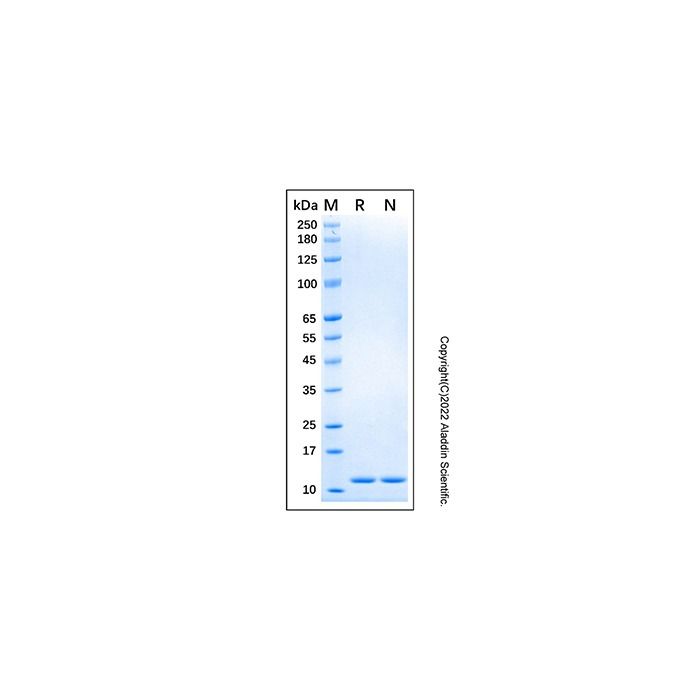 Recombinant Human UbcH5b/UBE2D2 Protein -    by Aladdin Scientific