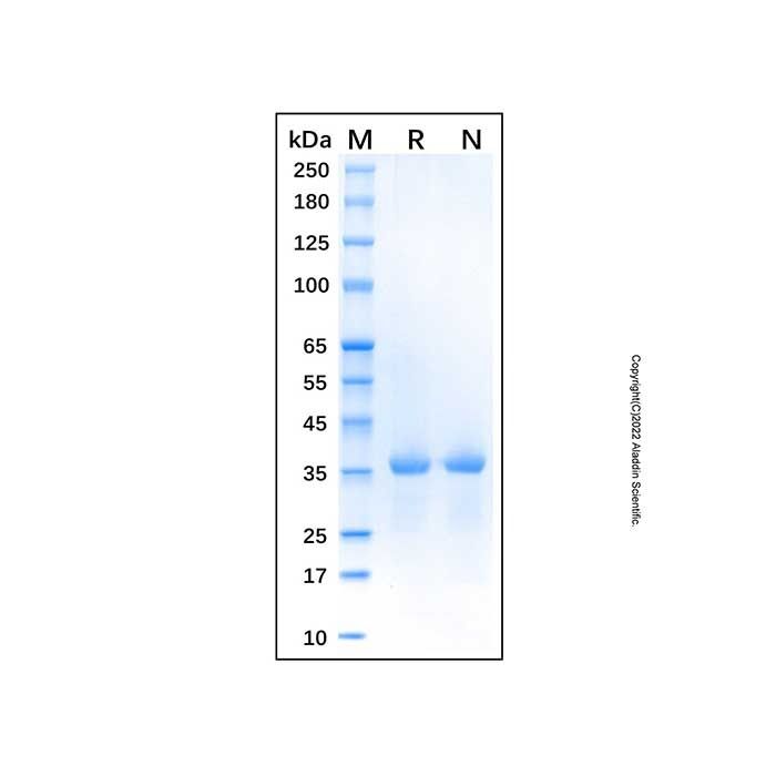 Recombinant Human HTRA1 Protein -    by Aladdin Scientific