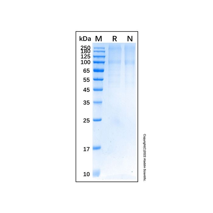 Recombinant Human TGF-beta RIII Protein -    by Aladdin Scientific