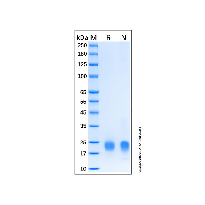 Recombinant Human HE4/WFDC2 Protein -    by Aladdin Scientific