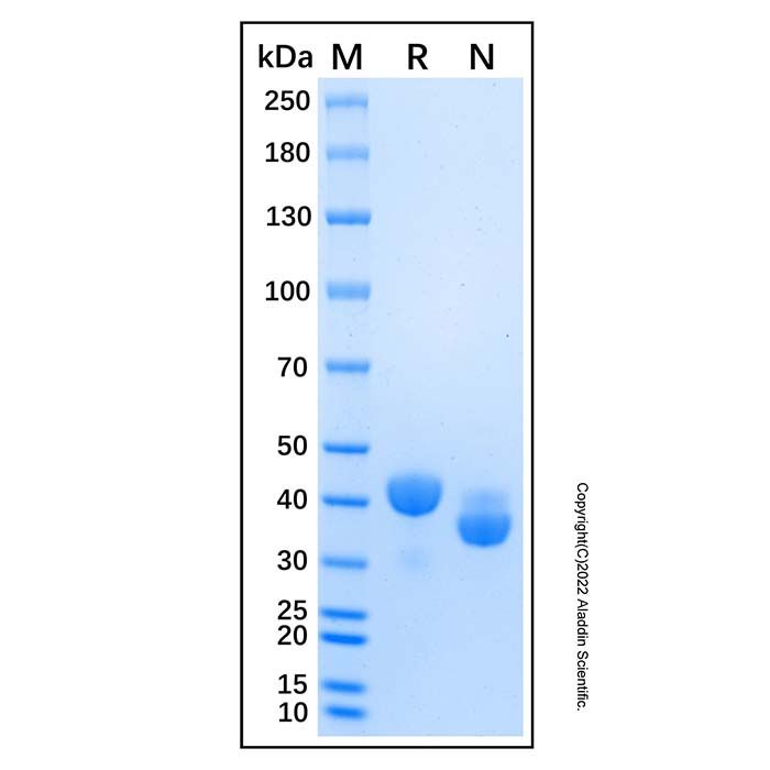 Recombinant Human SPARC Protein  -    rp181565 by Aladdin Scientific