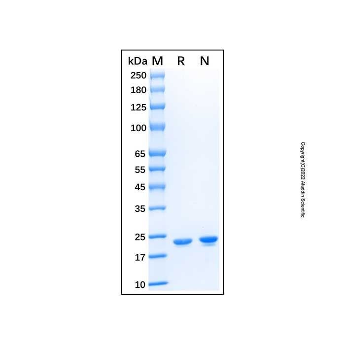 Recombinant Human Cardiotrophin-1/CT-1 Protein -    by Aladdin Scientific