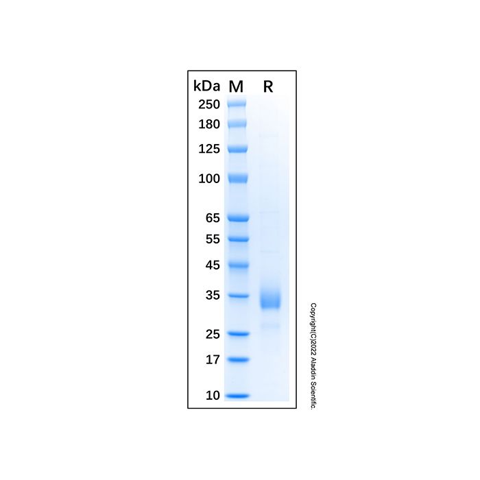 Recombinant Human CD72 Protein -    by Aladdin Scientific
