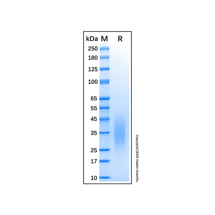 Recombinant Human CD79a Protein -    by Aladdin Scientific