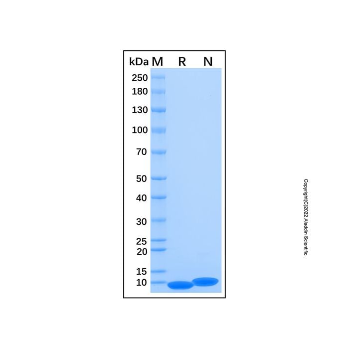 Recombinant Human CD81 Protein -    by Aladdin Scientific