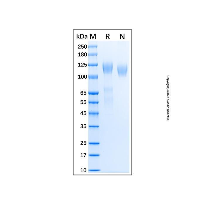 Recombinant Human VEGFR3/Flt-4 Protein -    by Aladdin Scientific