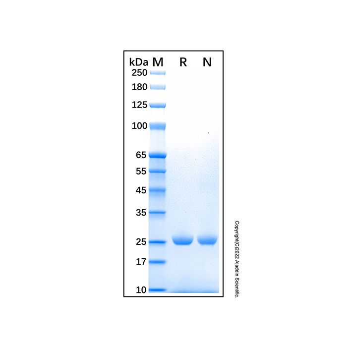 Recombinant Human UCH-L1/PGP9.5 Protein -    by Aladdin Scientific