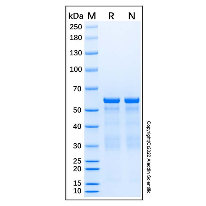 Recombinant Human AKT1 Protein -    by Aladdin Scientific