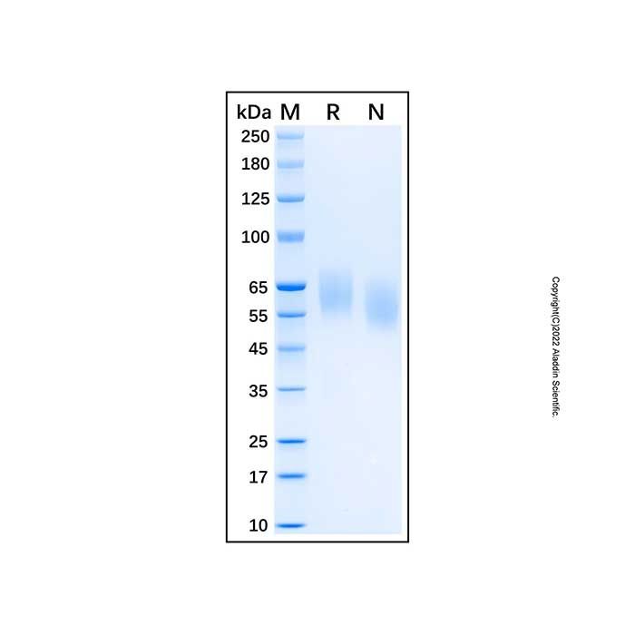 Recombinant Human Axl Protein -    by Aladdin Scientific