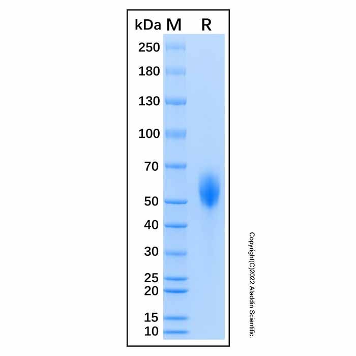Recombinant Human CD21 Protein -    by Aladdin Scientific