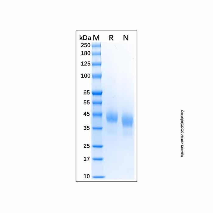 Recombinant Human Cathepsin B Protein -    by Aladdin Scientific