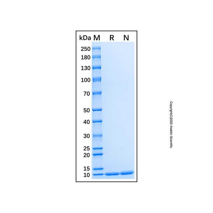 Recombinant Human GSK-3 beta/GSK3B Protein -    by Aladdin Scientific