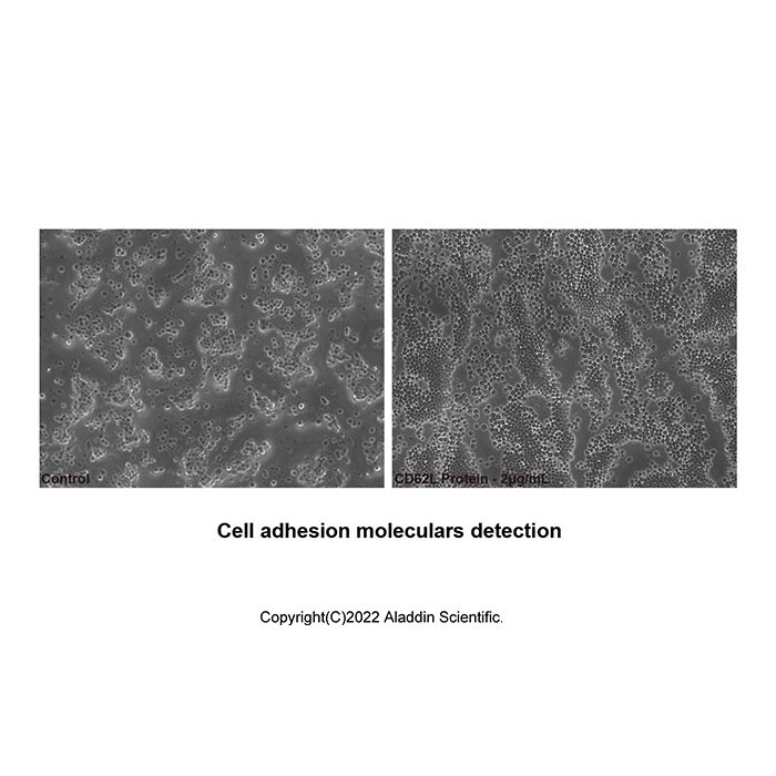 Recombinant Human L-Selectin/CD62L Protein -    by Aladdin Scientific