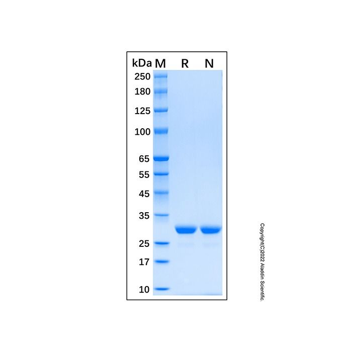 Recombinant Human Carbonic Anhydrase II Protein -    by Aladdin Scientific