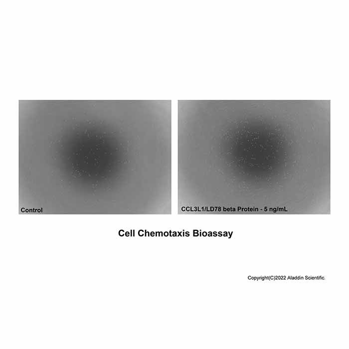 Recombinant Human CCL3L1/LD78 beta Protein -    by Aladdin Scientific