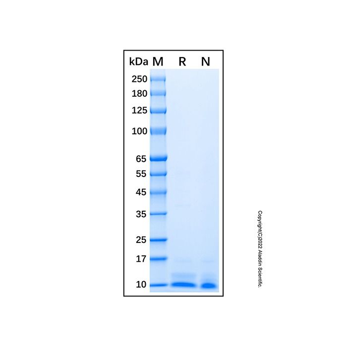 Recombinant Human Beta-Defensin 1 Protein -    by Aladdin Scientific