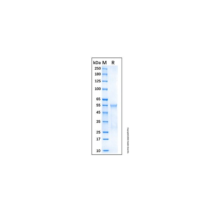 Recombinant Human AKT2 Protein -    by Aladdin Scientific