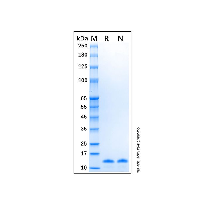 Recombinant Human Caveolin-1 Protein -    by Aladdin Scientific