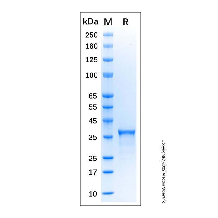 Recombinant Human Estrogen Receptor beta Protein -    by Aladdin Scientific