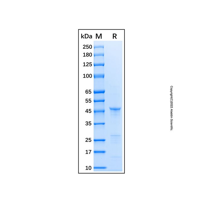 Recombinant Human KMT6/EZH2 Protein -    rp183733 by Aladdin Scientific
