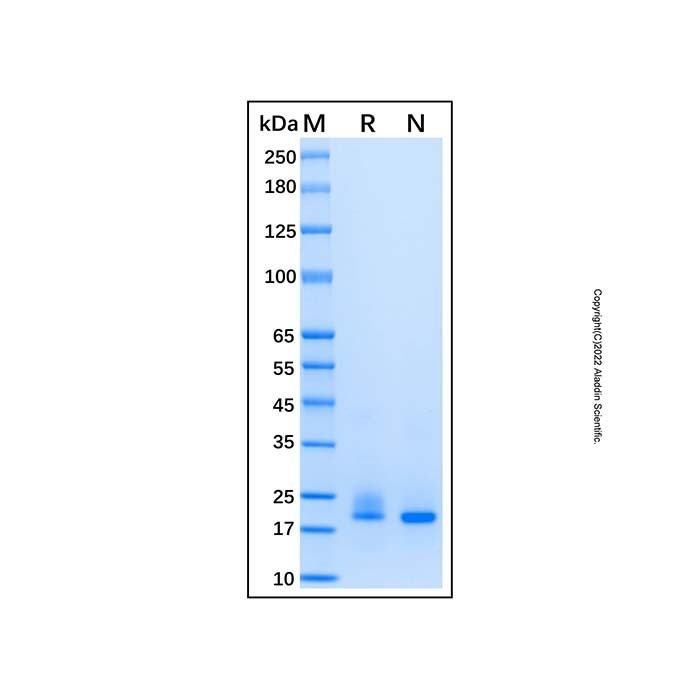 Recombinant Human RhoA Protein -    by Aladdin Scientific
