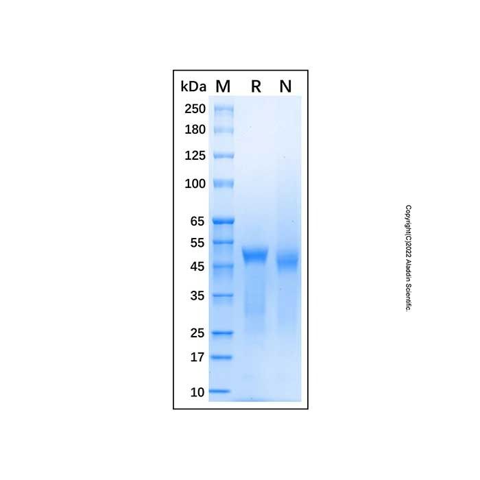 Recombinant Human beta III Tubulin Protein -    by Aladdin Scientific