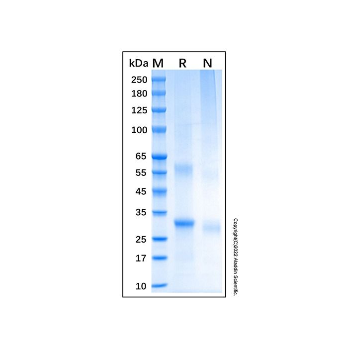 Recombinant Human NLRP3 Protein -    by Aladdin Scientific