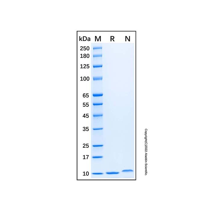 Recombinant Human CXCL5/ENA-70 Protein -    by Aladdin Scientific