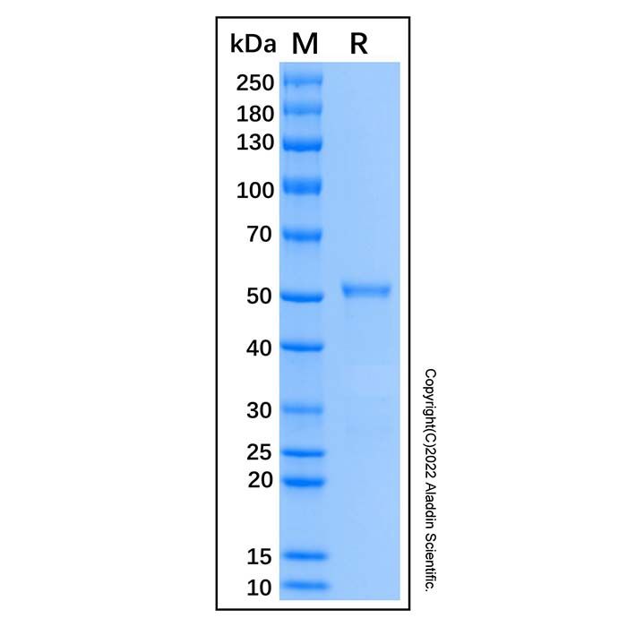 Recombinant Human Chk1 Protein  -    rp184097 by Aladdin Scientific