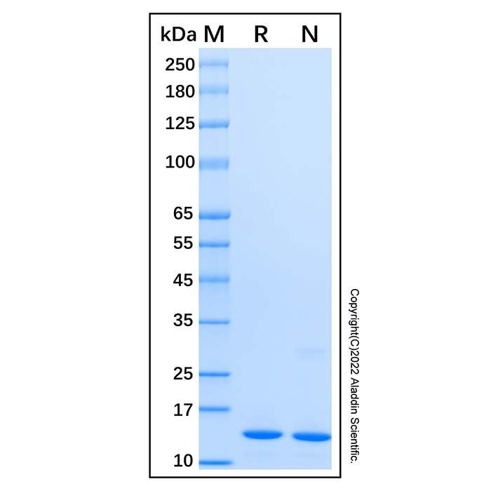 Recombinant Human FABP4 Protein -    by Aladdin Scientific